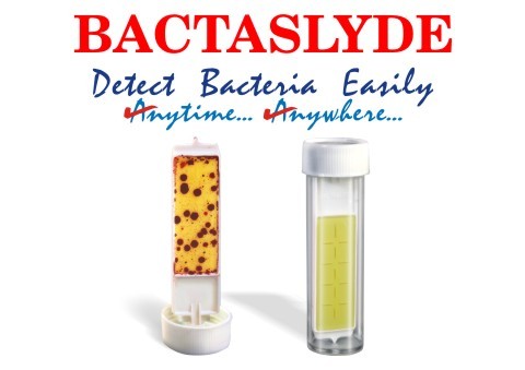 TBC/TVC Test Kits