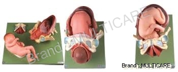 Demonstration Model of Child Birth - Life-Size PVC, Pink with Green Base | Realistic Uterus and Fetus Delivery Procedure Educational Tool
