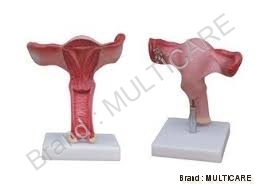 Magnified Uterus Model - Plastic, 1:1 Scale, Red | Detailed Anatomy, Coronal Section, Durable, Precise Design