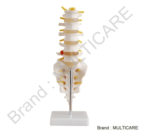 Lumbar Vertebrae with Sacrum & Coccyx and Herniated Disc Life Size - PVC Material, Off-White, On Stand | Detailed Anatomy, Durable, Educational Tool