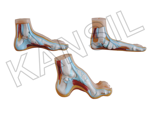 Normal Flat and Arched Foot Model