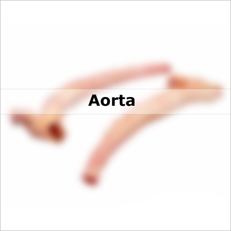Aorta