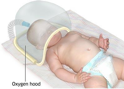 Oxygen Hood