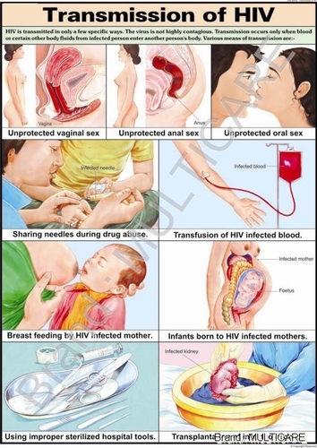Transmission Of HIV Chart - Polyart Synthetic Paper, 70 x 100 cm, Red | HIV Transmission Modes, Detailed Illustrations, Educational Tool, Glossy Lamination