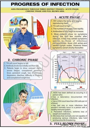 Progress of Infection Chart - Polyart Synthetic Paper, 70x100 cm | Detailed HIV Stages, Educational, Color Print