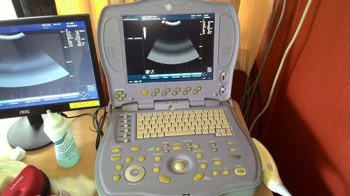 GE Logic XP Portable Ultrasound Machine.