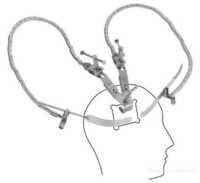 Leyla Retractor System