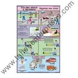 Electric Shock Treatment Chart