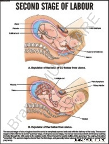 Second Stage Of Labour Chart