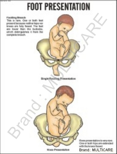 Foot Presentation Chart - Lamination Aluminum Frame 51x66cm, White, Roller Fitted, Expert Supervised