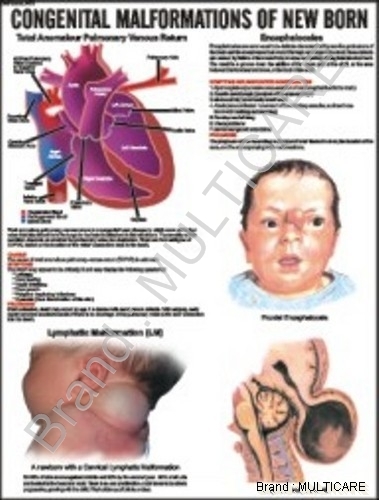 Congenital Malformation Of New Born Chart - Laminated Board 51x66cm Red, Aluminum Frame, Roller Mounted, Expert-Made Educational Chart