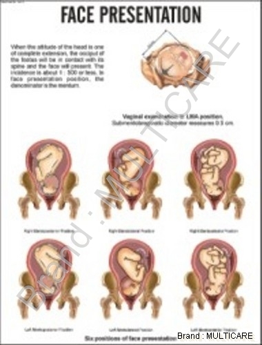 Face Presentation Chart