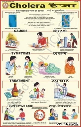 Cholera Chart - Laminated Plastic Film 60x45 cm White, Bilingual English/Hindi, Roller Mounted, Educational
