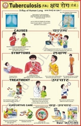 Tuberculosis Chart
