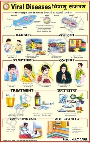 Viral Diseases Chart - Laminated Plastic, Roller Fitted, Bilingual English & Hindi, Multilingual Options