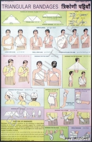 Triangular Bandages Chart