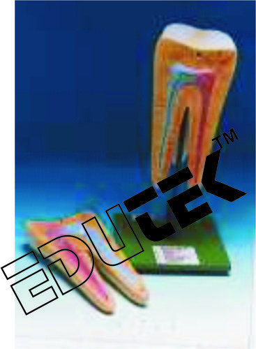 Human Tooth Molar