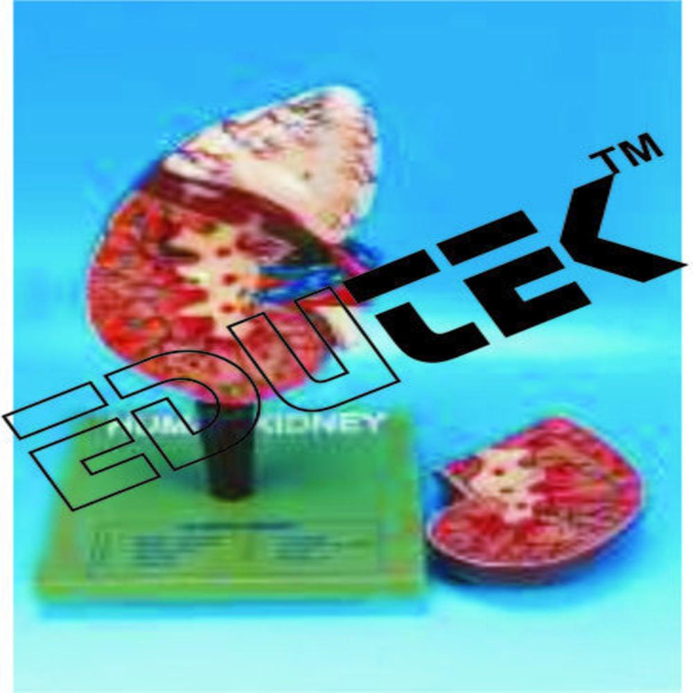 Human Kidney With Adrenal Gland - Plastic And Fiber Material, 1kg Weight , Dissectable Educational Anatomical Model On Stand With Key Card