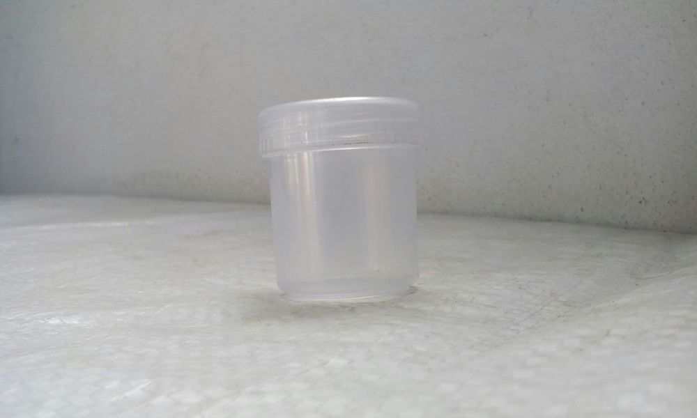 Plastic Urine Container