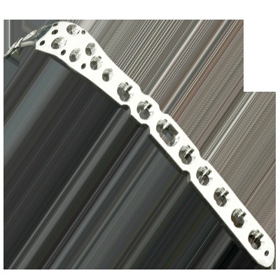 dclc proximal ulana plate