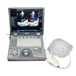 Portable Color Doppler Ultrasound Machine