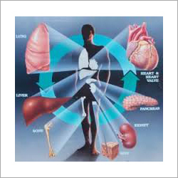 Multi Organ Transplant