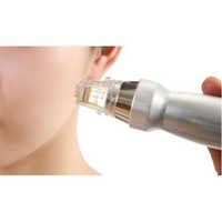 Fractional Rf Laser