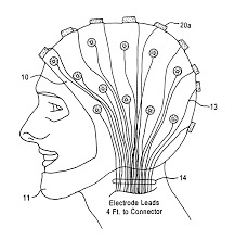 MRI Compatible Electrodes
