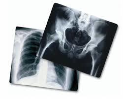 Medical X-Ray Film