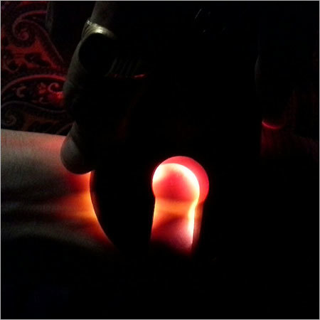 Mobile Vein Finder Device