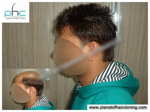 SOUTH DELHI # Professional Clinics for Mena s Natural Hair Bonding