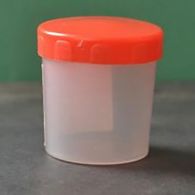 Urine Sample Container