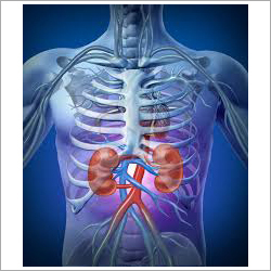Kidney Transplant