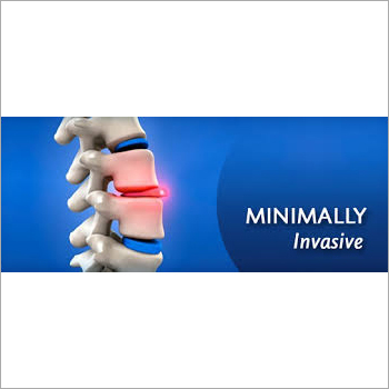 Minimally Invasive Surgery
