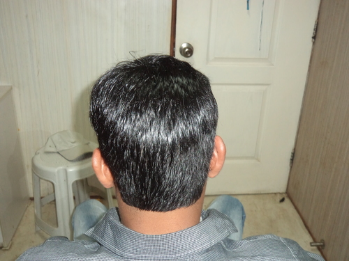 Hair Silicon System in Delhi