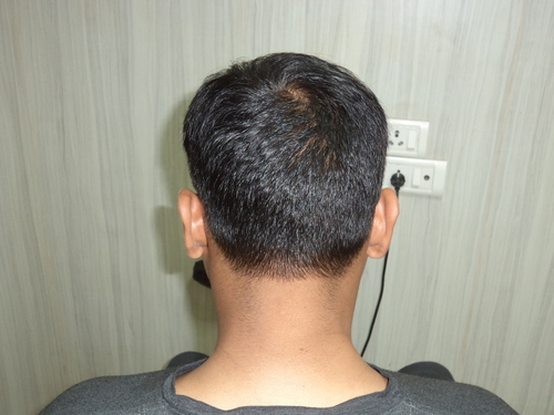Wigs Manufacturers in Delhi