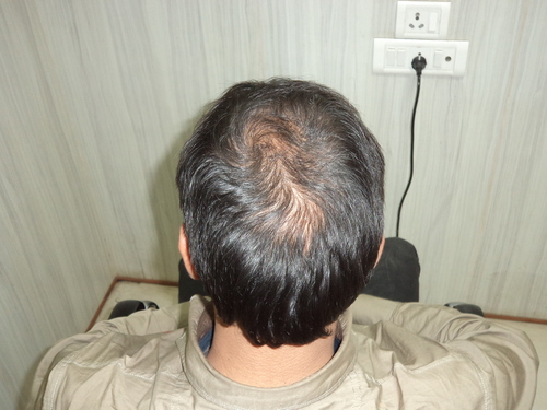Lace Front Wigs in Delhi