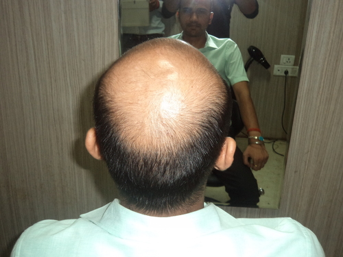 Wigs in Faridabad