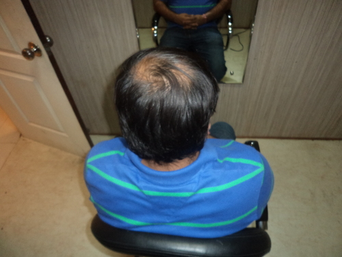 Hair Wigs for Women in Delhi