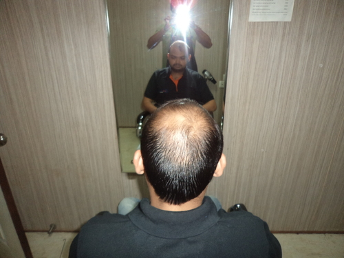 Mens Hair Wigs in Delhi