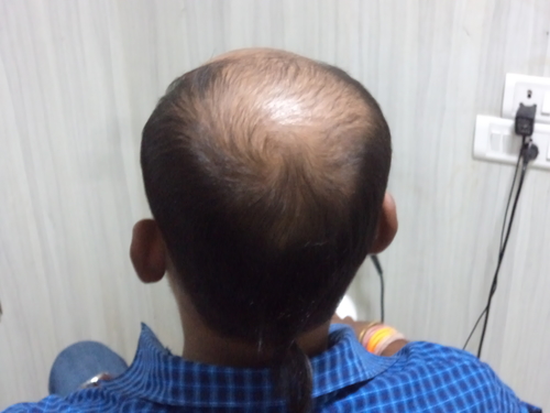 Hair Wigs Shop in Gurgaon