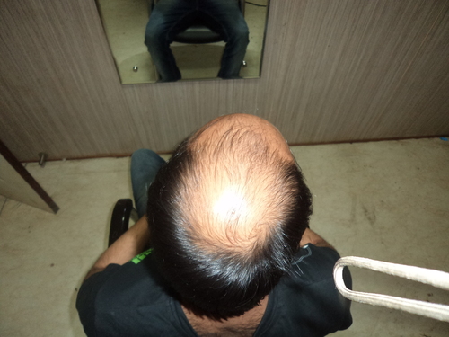 Hair Wigs in Faridabad