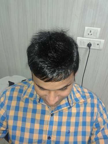 Hair Wig price in Delhi