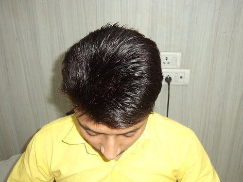 Hair Wig for Men in Delhi