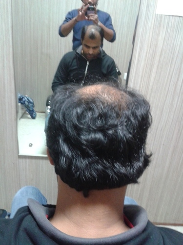 Hair Wig in Gurgaon