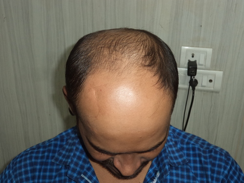 Wig Manufacturers in Delhi
