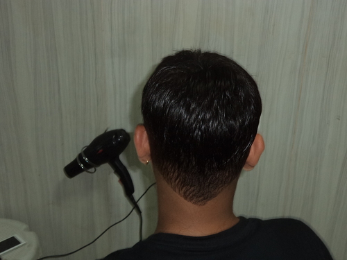 Hair Patches in Delhi