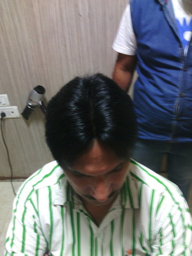 Hair Patches In Noida