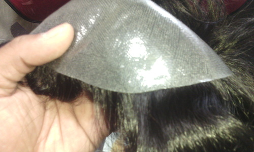 Hair Patches in Gurgaon