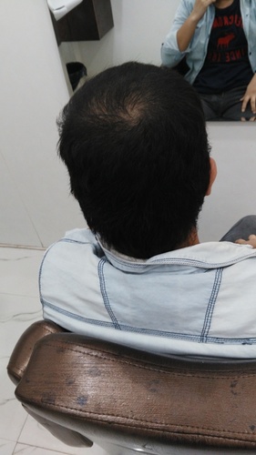 Hair Bonding in Noida